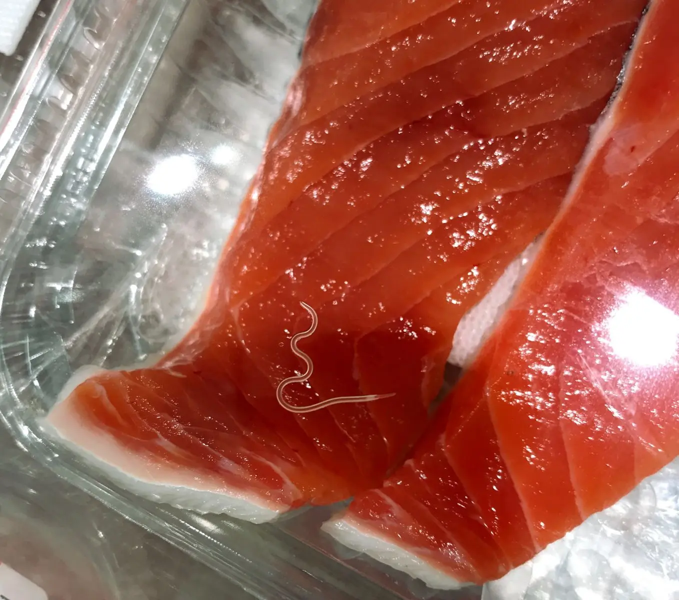 parásito del pescado crudo - Cuáles son los síntomas de anisakis